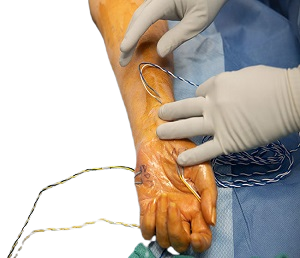 Comprehensive neuro-trauma services