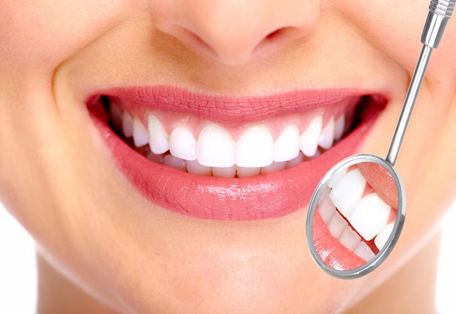 dental-peeling-1
